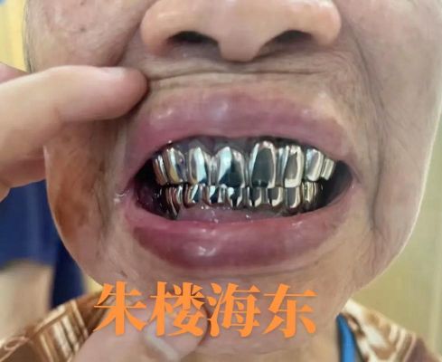 大鼻同钢牙哪个是哥哥?