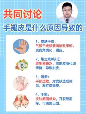 为什么电子厂不收手脱皮的